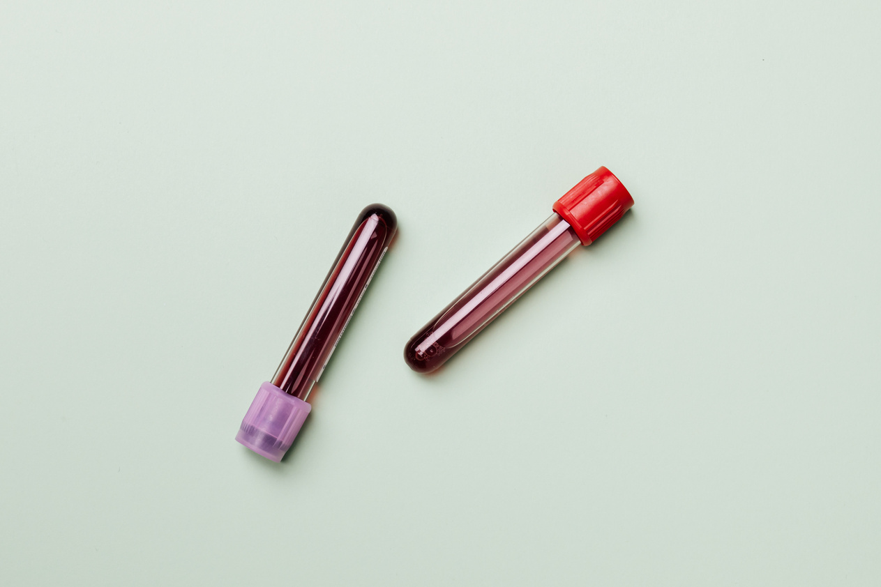 Comprehensive bloodwork